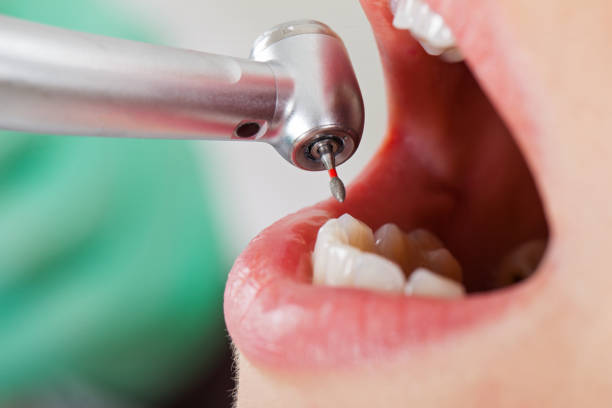Best Broken Tooth Emergency  in Stevenson, AL